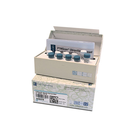 Ras (E4K9L) Rabbit mAb #91054